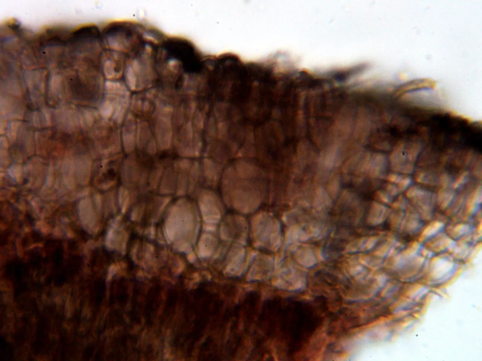 Microscopía de Sclerococcum stygium - 13 - Hifas marginales